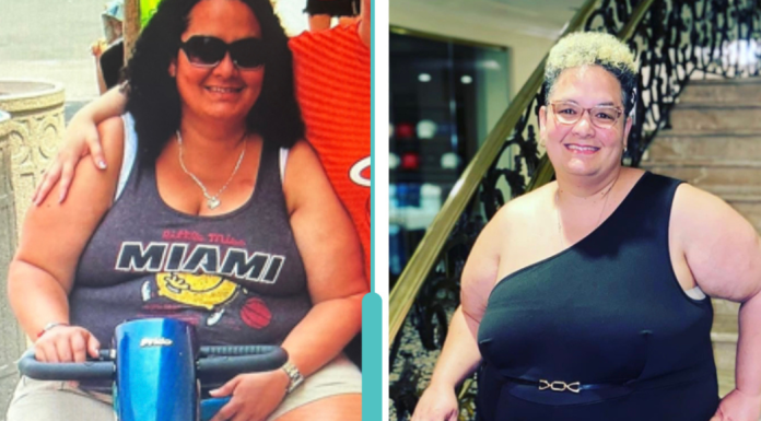 Congestive Heart Failure: A Miami Mom’s Journey With CHF Image: Natasha getting around in a scooter, versus the active woman she is today