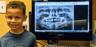 Common Pediatric Dental Procedures, Part 1 | Dr. Bob Pediatric Dentist A pediatric dental patient pictured next to one of his x-rays