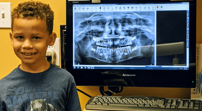 A pediatric dental patient pictured next to one of his x-rays