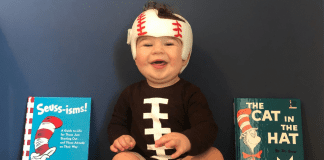 Jessica's son with a cranial helmet (Plagiocephaly and a Cranial Helmet: It's Not As Scary As It Looks Jessica Socarras Contributor Miami Mom Collective)