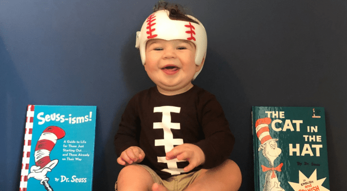 Plagiocephaly and a Cranial Helmet: It’s Not As Scary As It Looks Jessica's son with a cranial helmet (Plagiocephaly and a Cranial Helmet: It's Not As Scary As It Looks Jessica Socarras Contributor Miami Mom Collective)