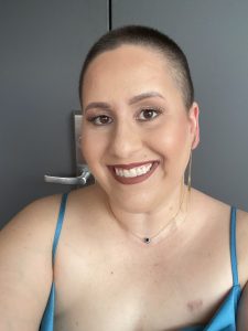 Image: Jackie smiles as her hair begins to grow back during radiation